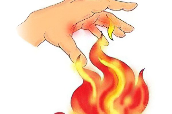 Ожоги первая медицинская помощь при термических ожогах thumbnail